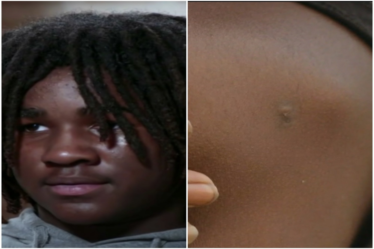 Louisiana Deputy Shot 14-Year-Old Unarmed Black Boy, Then Officials Remained Silent About It for Three Months Until They Were Exposed