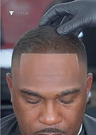 Titan Grooming | Semi-Permanent Hair Enhancements for Men [US]